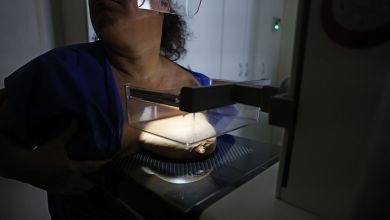 Mamografia digital em exame de diagnóstico de câncer de mama